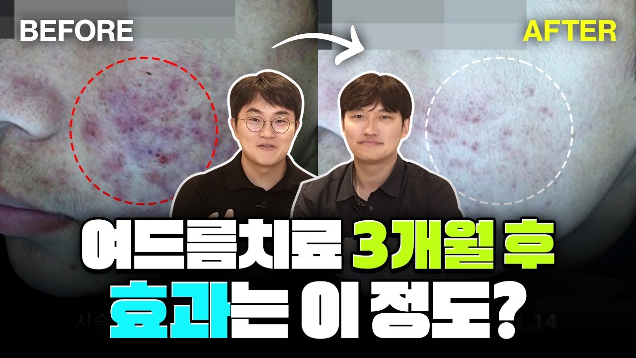 포에버유튜브