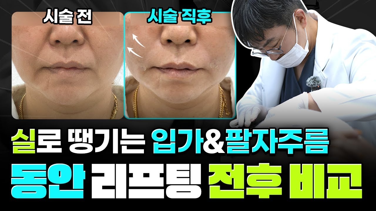 포에버유튜브