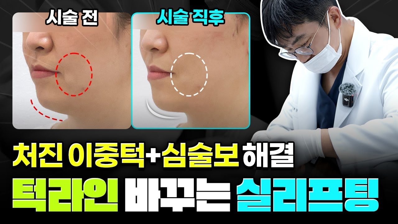 포에버유튜브