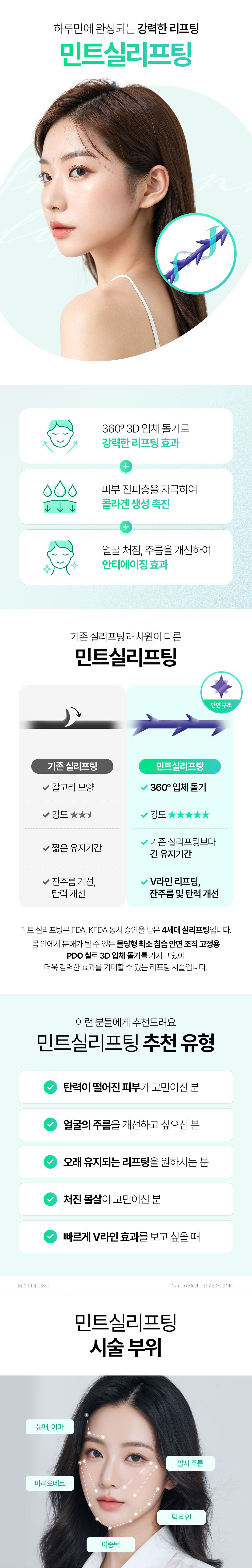 민트실리프팅